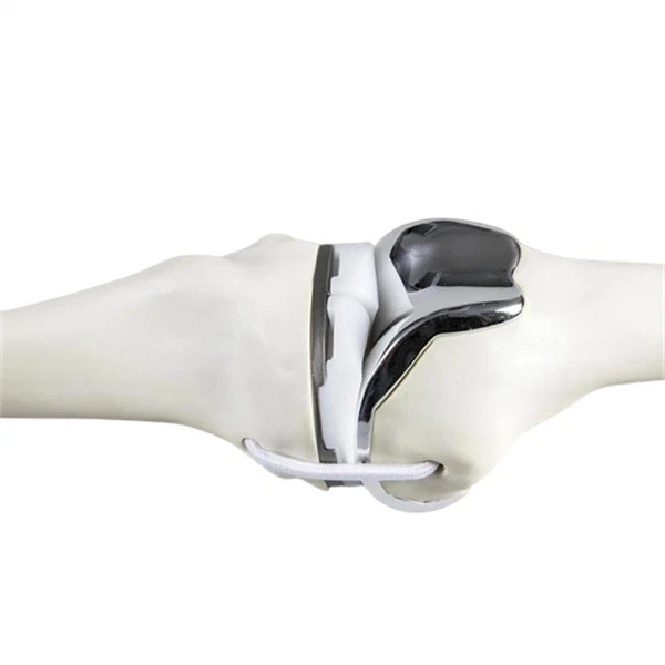 Titanium_alloy_metal_injection_molded_bone_joint_replacement_parts_1716104296903_2.jpg_w720